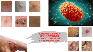 monkeypox pictures